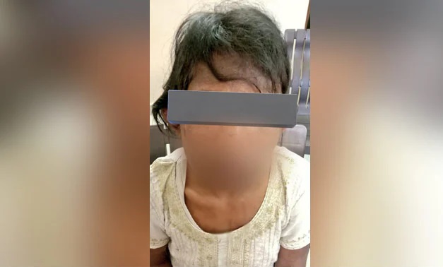 Gurugram horror: 13-Year-old domestic help physically abused, tortured by couple; Rescued