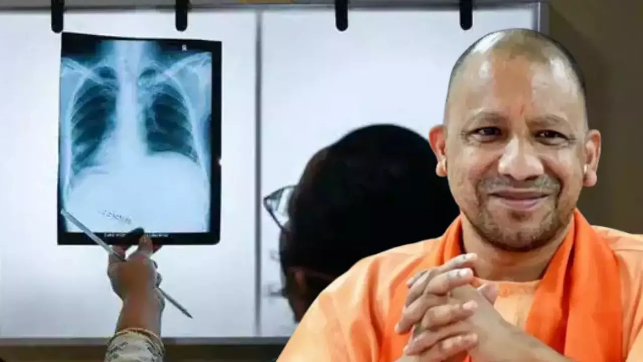 Uttar Pradesh Government Launches Active Tuberculosis Patient Search Campaign to Eradicate TB