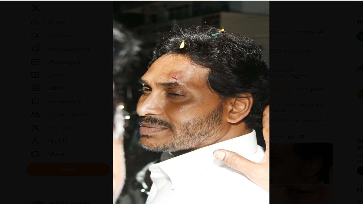 Stone attack on CM: Jagan Reddy sustain injuries after stones pelted during roadshow in Vijayawada